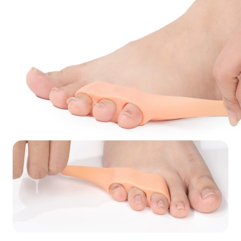 1/2/5/10Pairs Bunion Toe Corre - Toe Separator Silicon recension och pris