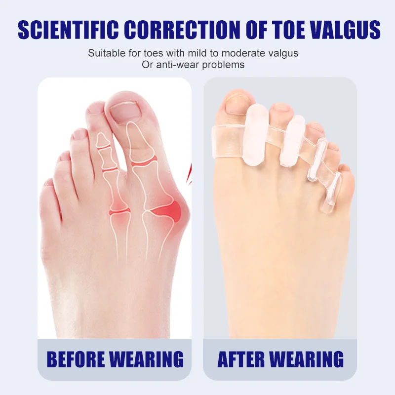 1 Pair Silicone Toe Separator  - Toe Separator Silicon recension och pris