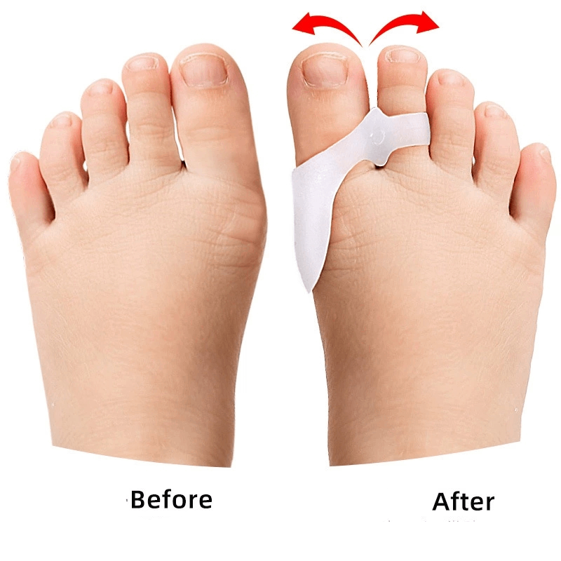 1/2/3Pairs Children's Gel Toe  - Toe Separator Silicon recension och pris