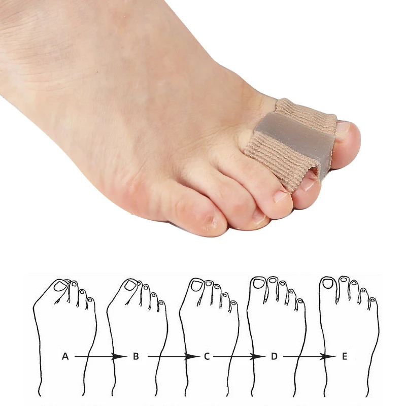 Gel Bunion Toe Separators W/Fa - Toe Separator Silicon recension och pris